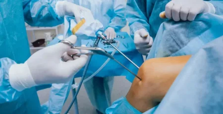 Chirurgie arthroscopique