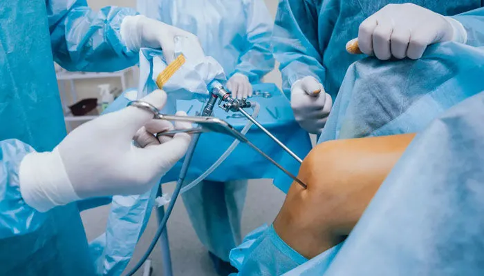 Chirurgie arthroscopique
