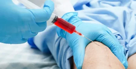 تقنية البلازما الغنية بالصفائح الدموية