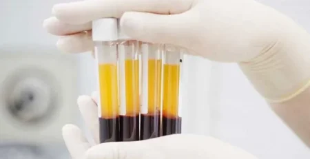 Le PRP, Plasma Riche en Plaquettes
