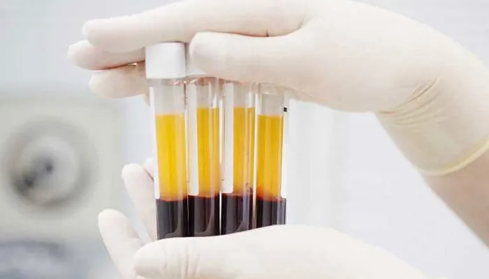 Le PRP, Plasma Riche en Plaquettes